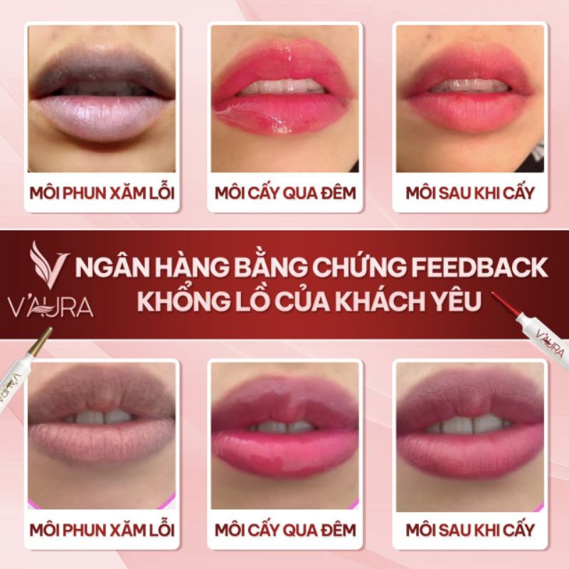 SALE *** Combo Tinh chất Cấy hồng môi Babier Lip Volum