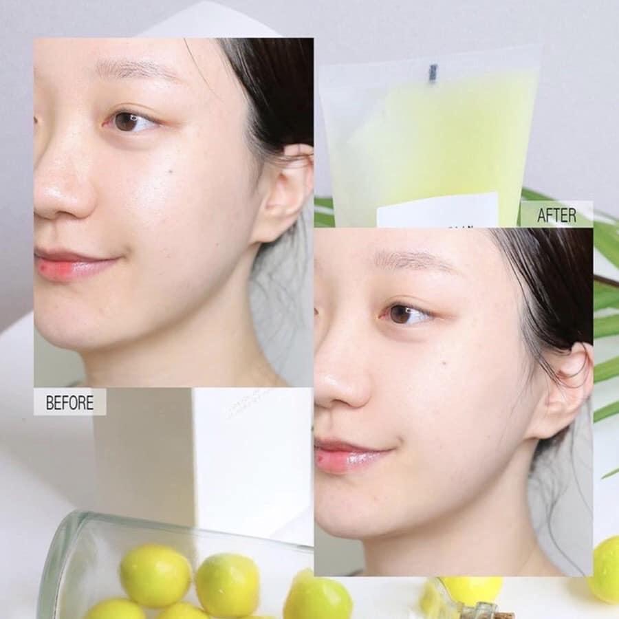 GEL TẨY DA CHẾT MẶT DỨA TRẮNG SÁNG DƯỠNG DA PEELING GEL GRAYMELIN MILD