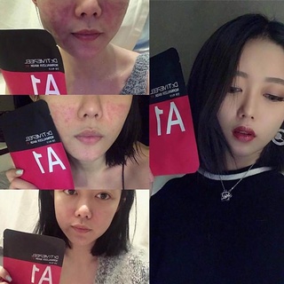 Mặt nạ dành cho da mụn DR.TIMEPEEL A1 NORMALIZER MASK lẻ