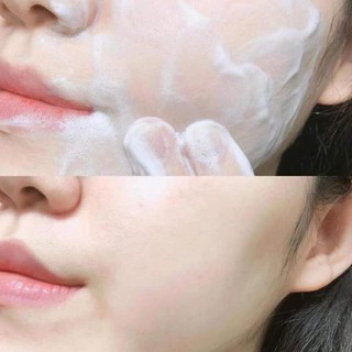 RỬA MĂT DẠNG BỘT SỦI BỌT INCELLDERM