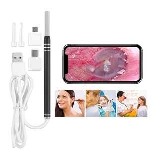 Bộ Dụng Cụ Lấy Ráy Tai Có Camera 4.3mm