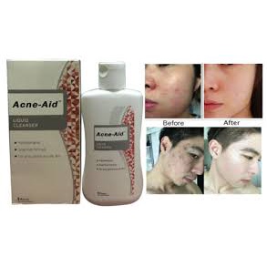 ✅ CHÍNH HÃNG KÈM QUÀ TẶNG sữa rửa mặt Acne - Aid Liquid 100ml  ACNE AID ACNE AID TẶNG BÔNG TẨY TRANG CALLA BT