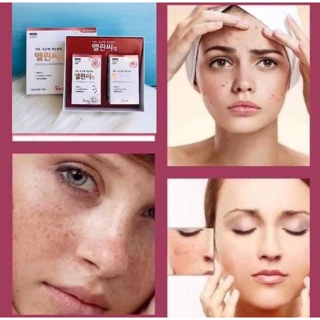 HÀNG TIÊU DÙNG_HÀNG XÁCH TAY