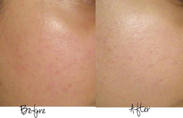 Serum Estee Lauder Advanced Night Repair 7ml | BigBuy360 - bigbuy360.vn