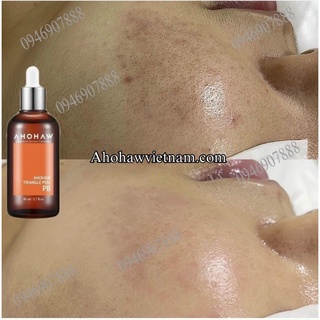 [Chính hãng]Dung dịch Peel PB Ahohaw