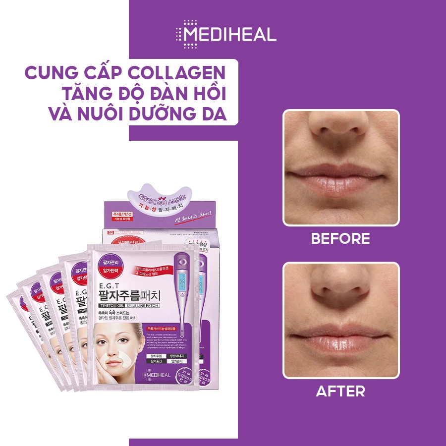 Mặt Nạ Chống Nhăn Cho Vùng Khóe Môi Mediheal E.G.T Timetox Gel Smile-Line Patch 25ml [K34]