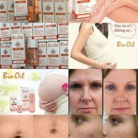 Rạn da Bio oil