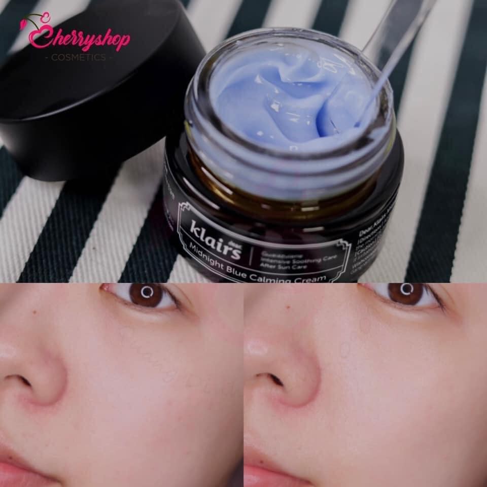 Kem dưỡng KLAIRS Midnight Blue Calming Cream