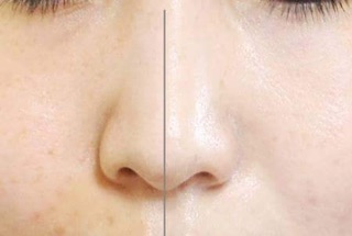 Kem tươi Dr Cell Hàn Quốc 50ml