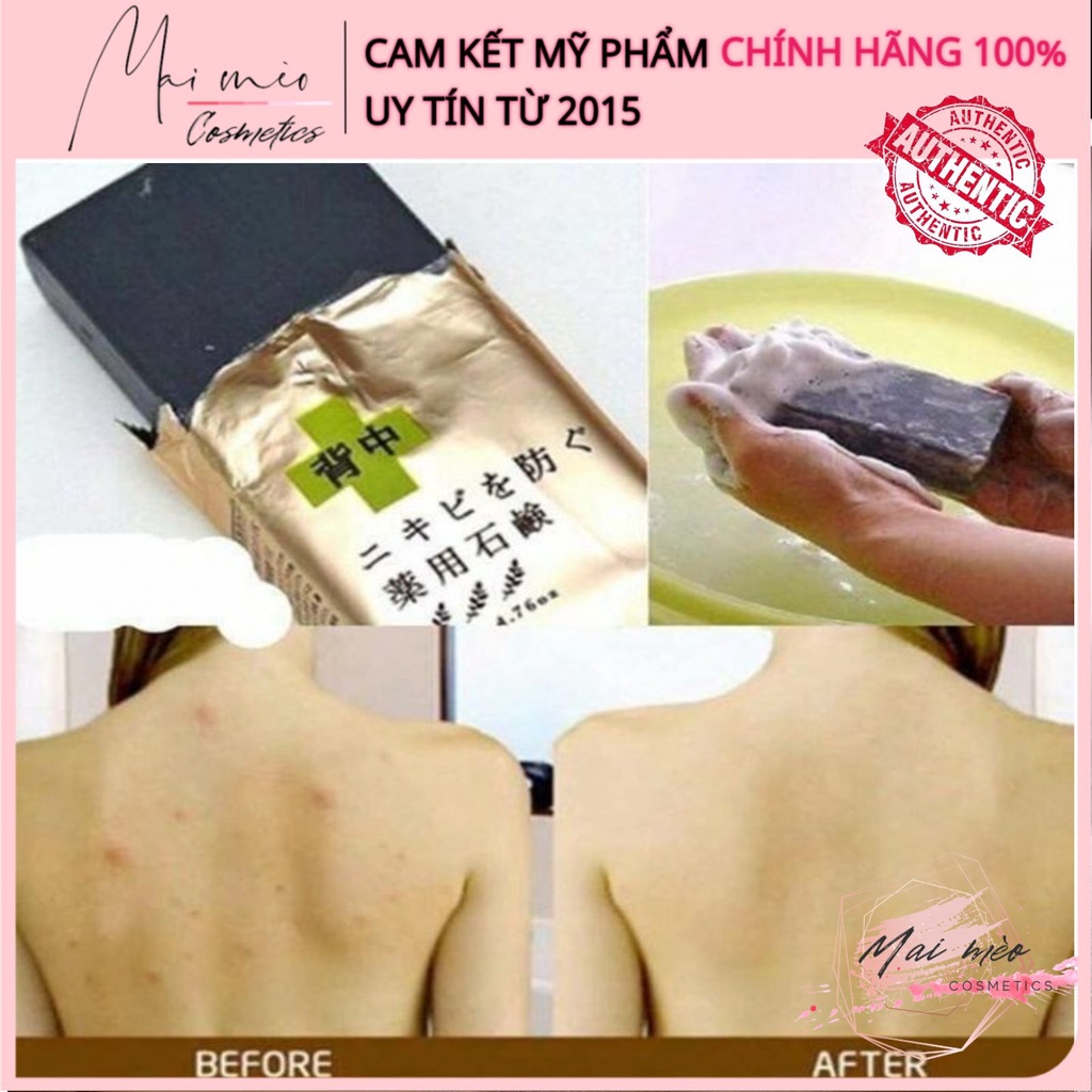 Xà phòng For Back ngừa mụn lưng Nhật Bản