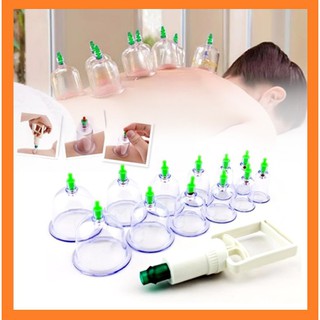 Bộ giác hơi 12 cốc nhựa - giác hơi không dùng lửa