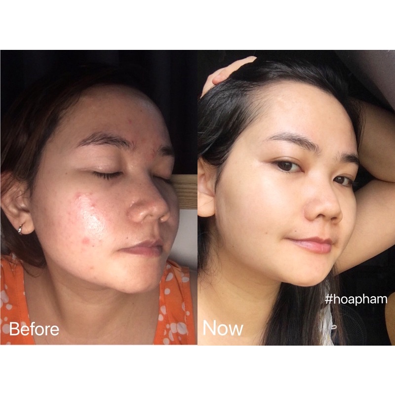 PG COLLAGEN SỤN CÁ HỒI MOREPAS CARE EX (MỚI)