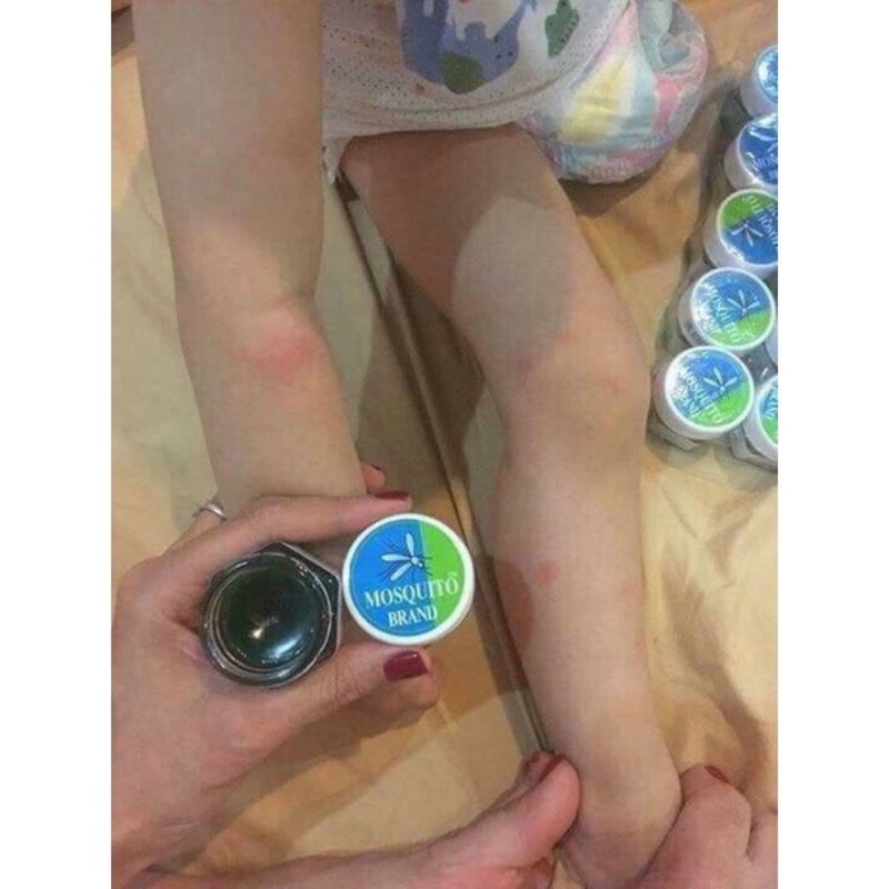 Cao muỗi Thái Lan Dầu thoa xử lý muỗi đốt Mosquito Balm Thái Lan-ShopMeKhoai