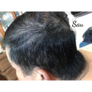 Dầu gội phủ bạc Thường Xuân
