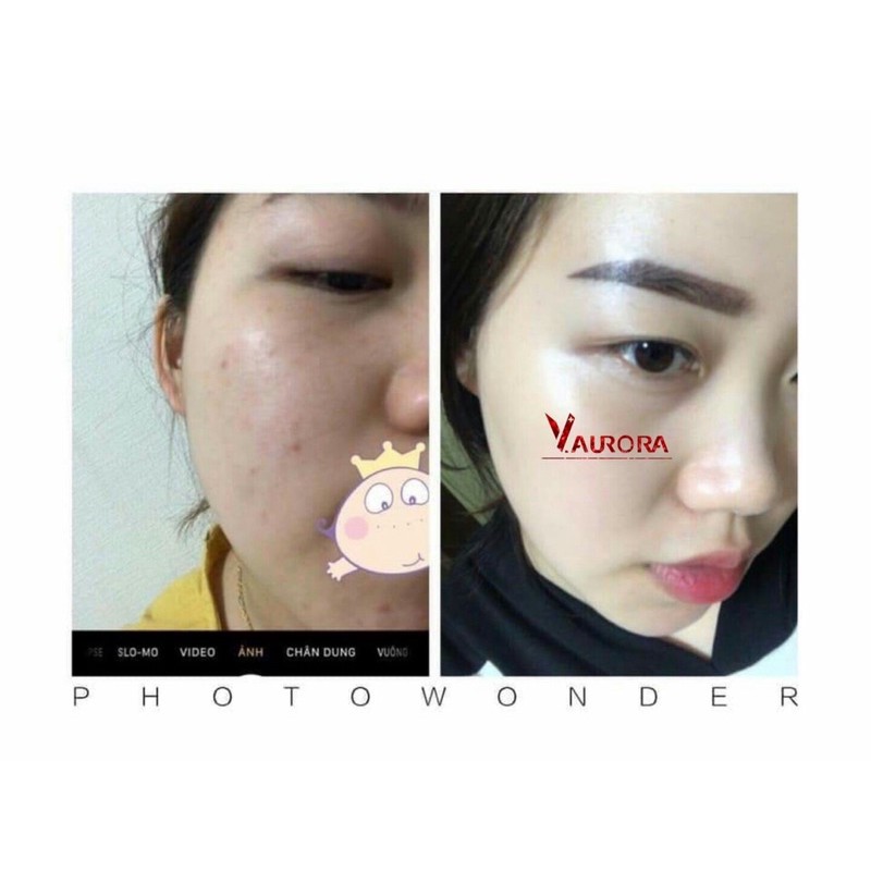 Combo dưỡng phục hồi | BigBuy360 - bigbuy360.vn