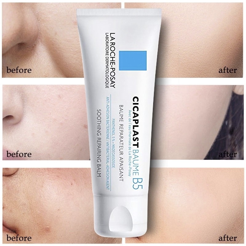 Kem dưỡng làm dịu kích ứng và phục hồi da La Roche Posay Cicaplast Baume B5