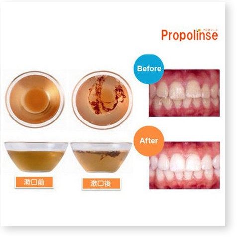 [Mã chiết khấu giảm giá mỹ phẩm chính hãng] Nước súc miệng của Nhật Bản Propolinse Chính hãng