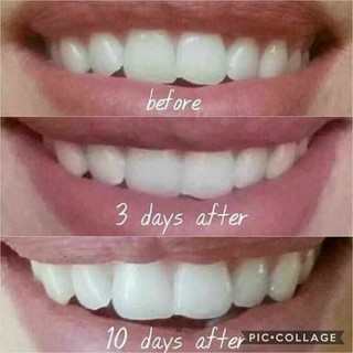 Serum Tẩy Trắng Răng Tobe White 7ml