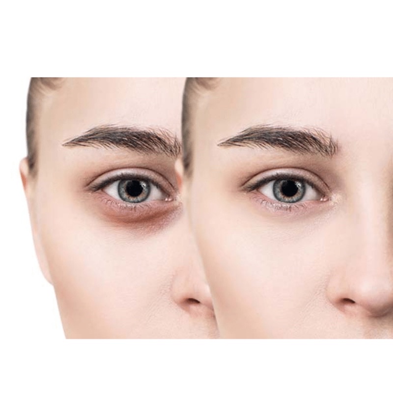 Máy massage mắt URI-K88 chống cận thị xoá quầng thâm và bọng mắt với công nghệ litugen và Microcurrent Facial