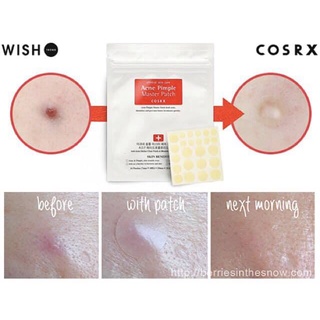 Miếng dán mụn Cosrx Acne Pimple Master Patch/Clear Fill Master Patch
