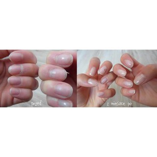 Serum Dưỡng Móng Eveline 8in1 - Hàng Nga