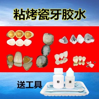Răng giả keo tự làm dính sứ răng keo cố định nẹp tràng hoa dính tất cả sứ kim loại răng keo đặc biệt 9.8