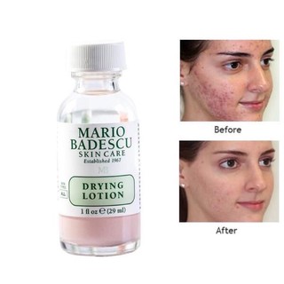 Chấm mụn Mario Badescu Drying Lotion 29ml