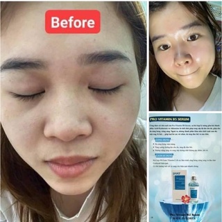 [Chính Hãng CTY] Serum B5 Smas cấp nứơc siêu phục hồi da