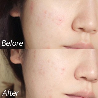 MẶT NẠ RAU MÁ ĐẤT SÉT STEADY:D CICA LEAF CLAY MASK  Steady:D
