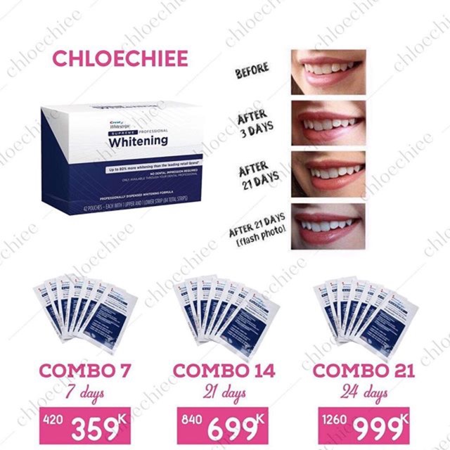 Miếng dán trắng răng Crest- set 21 miếng
