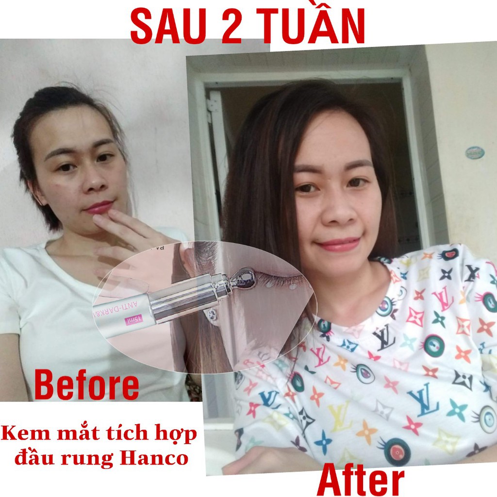 kem mắt giúp massage mắt, giảm thâm quầng, bọng mắt, xóa nếp nhăn mắt hanco doctor eye dang cây massage thư giãn mắt