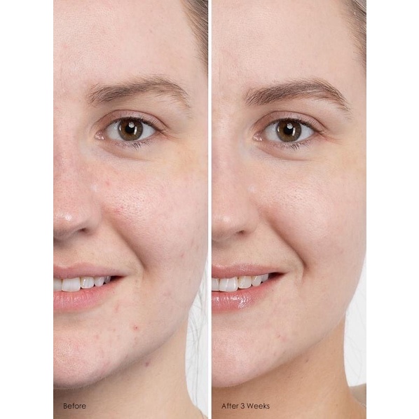 Kem dưỡng Vinoperfect Caudalie