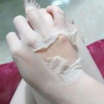 Lột thâm gối , thâm nách , bẹn mông 4k Plus