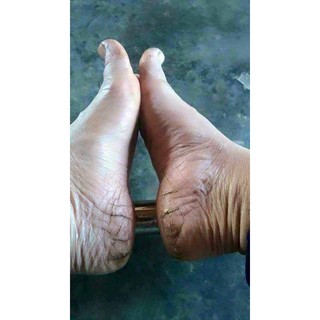Công dụng mỡ trăn