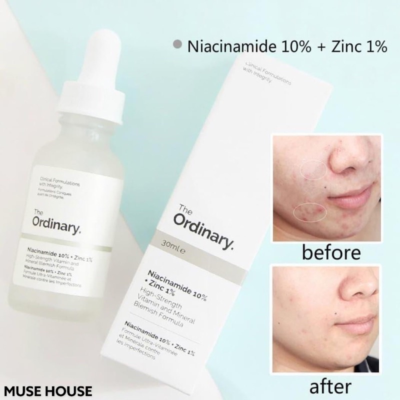 Tinh Chất giảm thâm mụn The Ordinary Niacinamide ZinC