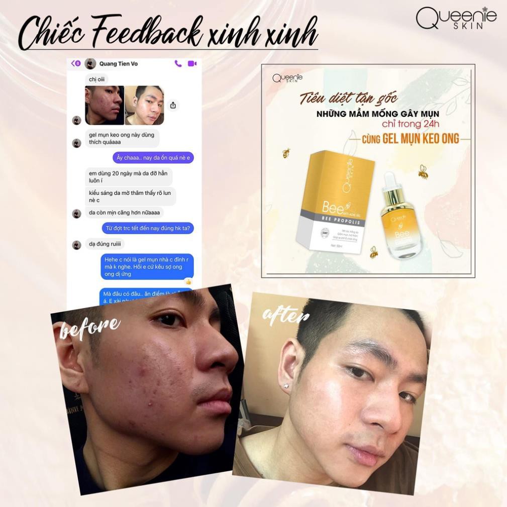[Rẻ vô địch + Tặng Quà] Gel Mụn Keo Ong Queenie Skin Date Mới Nhất - Gel Mụn Queenie Skin Date 2023