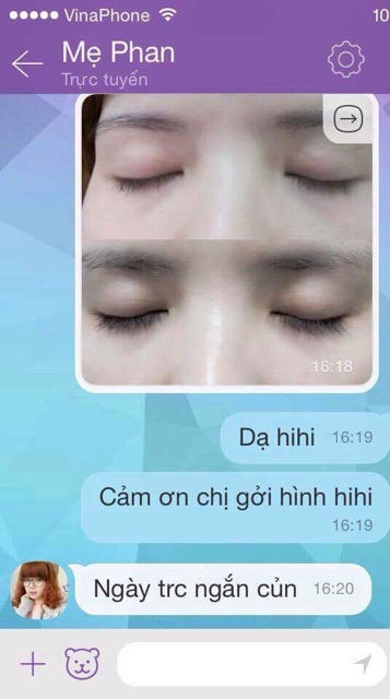 Thuốc dưỡng mi và lông mày Careprost