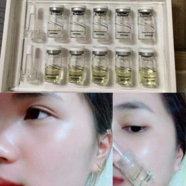 [Chuẩn Hàn]CHITOSSIL - CẤY CHỈ TƠ TẰM (TÁCH SET 2 LỌ)