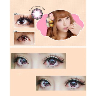 CONTACT LENS VÂN HOA LỬA