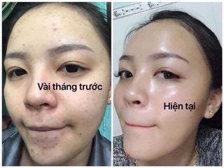 Mask Sữa Ong Chúa Tinh bột nghệ