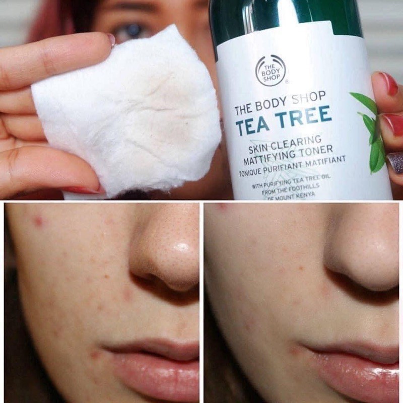 Toner Da Dầu Mụn The Body Shop Tea Tree Skin Clearing Mattifying Toner