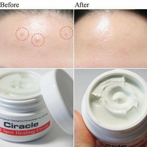 Kem Giảm Mụn Ciracle Red Spot Cream 30g