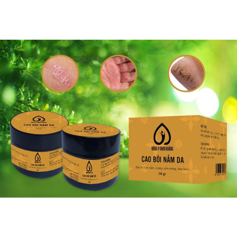 Chàm da,  Bong Tróc da,Ngứa da bàn tay