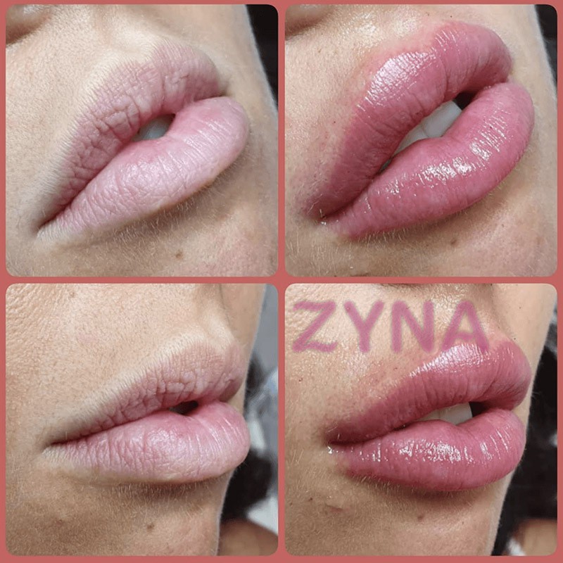 ( Mypham35 ) [Hàng mới về] Tinh chất nuôi dưỡng chăm sóc môi hiệu quả | BigBuy360 - bigbuy360.vn