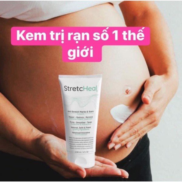 Kem rạn da Stretc.Heal