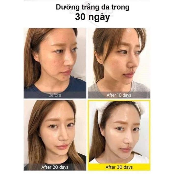 Serum Yuja Niacin Blemish Care 50ml của Some By Mi hỗ trợ sáng da mờ vết thâm | BigBuy360 - bigbuy360.vn