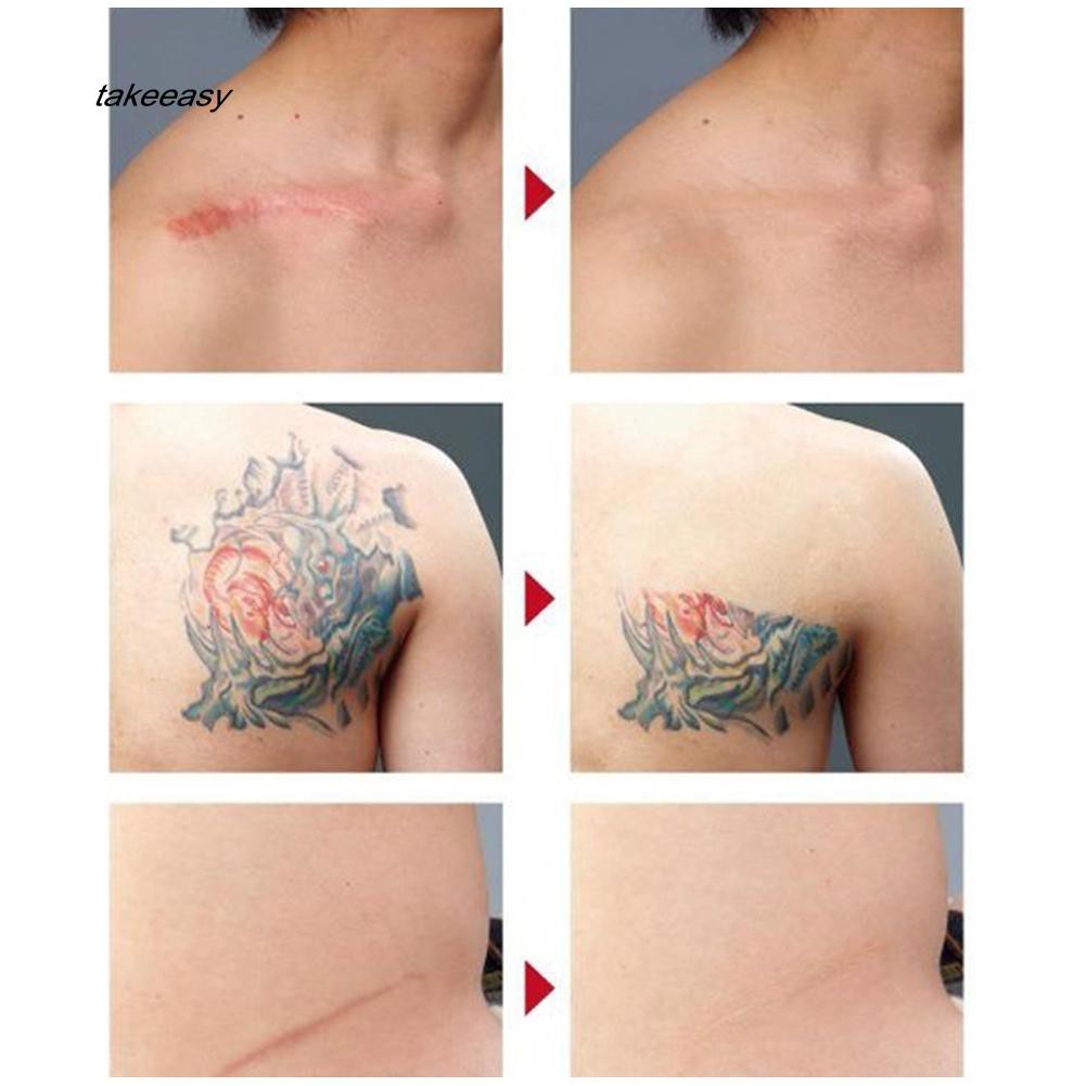 [Hàng mới về] Kem che khuyết điểm làm sáng da và làm mờ vết thâm