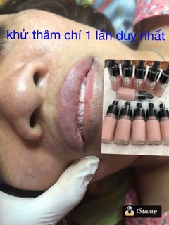 Khử thâm hoàn toàn cho môi