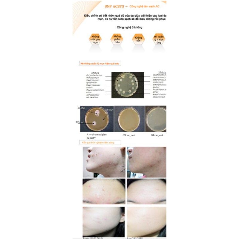 [Mã SKAMPUSH11 giảm 10% đơn 200k] Sữa rửa mặt cho da mụn SNP ACSYS Cleansing Foam 180g | BigBuy360 - bigbuy360.vn