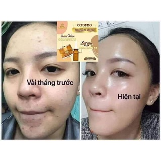 Kem Face Collagen X3 [Chính Hãng]